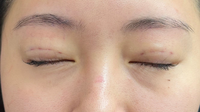 Postoperative Condition Part 1