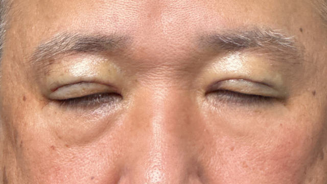 Postoperative Condition Part 1