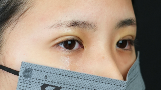 Postoperative Condition Part 1