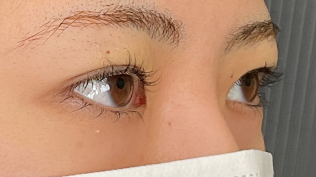 Postoperative Condition Part 1