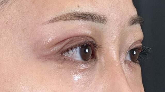 Postoperative Condition Part 1