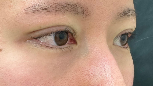 Postoperative Condition Part 1