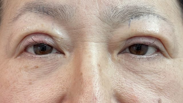 Postoperative Condition Part 1