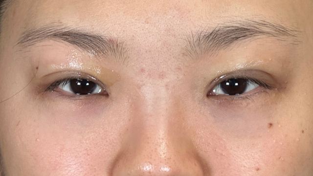 Postoperative Condition Part 1