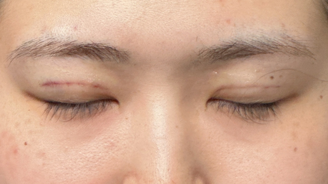 Postoperative Condition Part 1