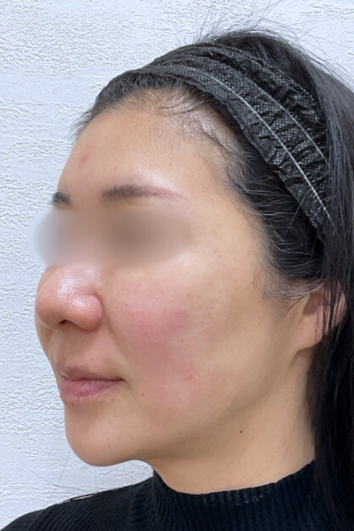 手術前の状態 その1