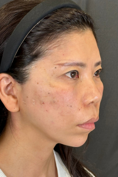 Postoperative Condition Part 1