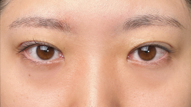 Postoperative Condition Part 1