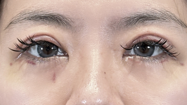 Postoperative Condition Part 1