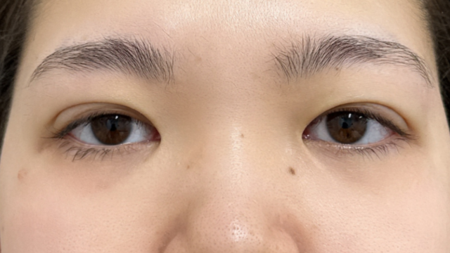 Postoperative Condition Part 1