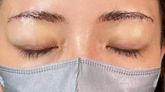 Postoperative Condition Part 1