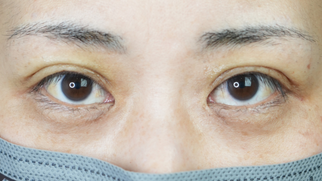 Postoperative Condition Part 1