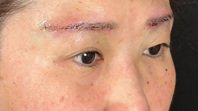 Postoperative Condition Part 1