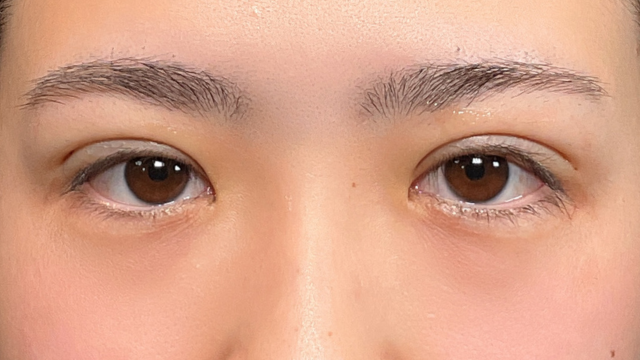 Postoperative Condition Part 1