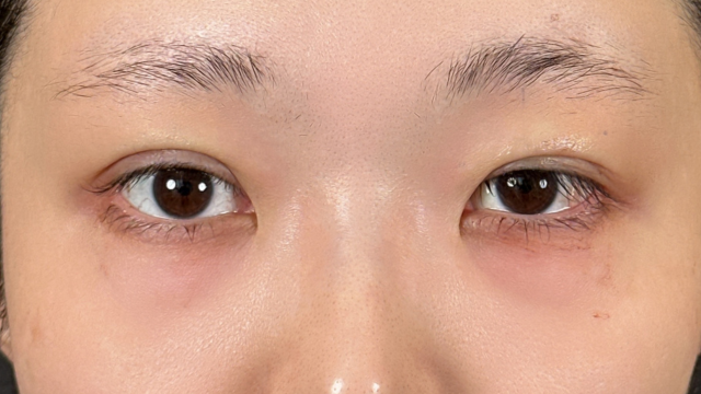 Postoperative Condition Part 1