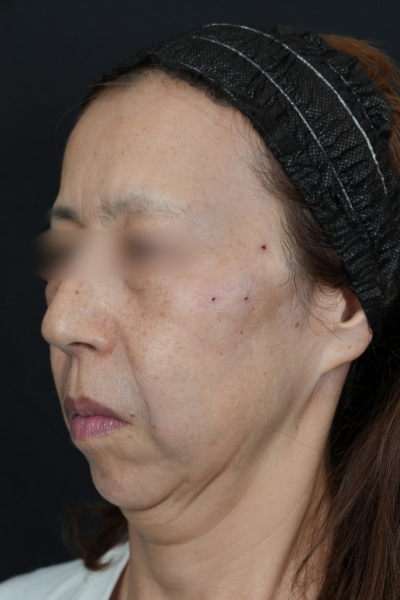 Postoperative Condition Part 1