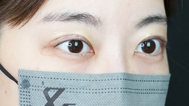 Postoperative Condition Part 1