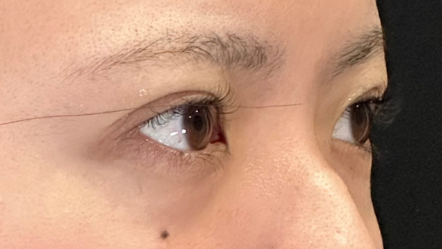 Postoperative Condition Part 1