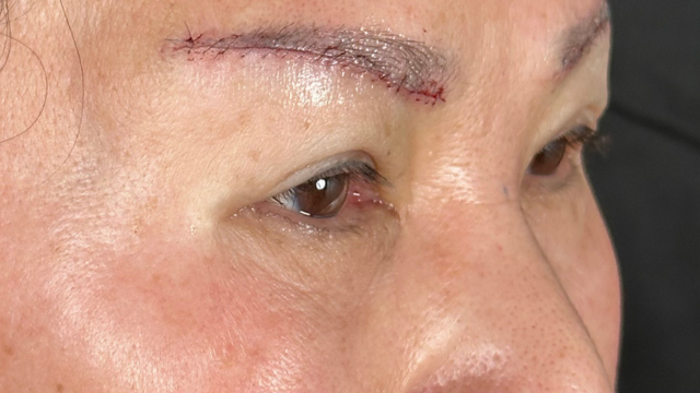 Postoperative Condition Part 1