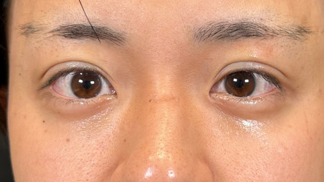 Postoperative Condition Part 1