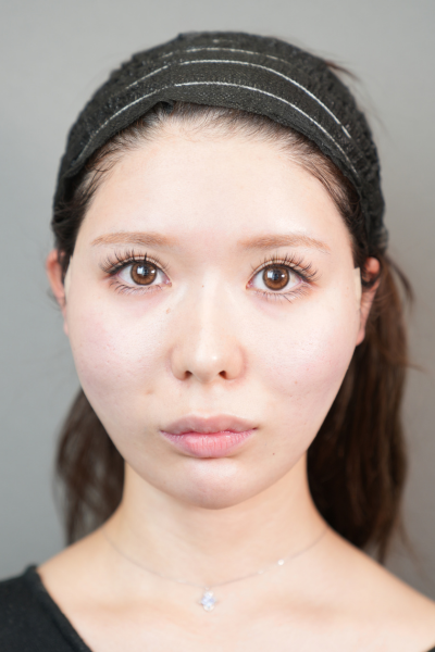 Postoperative Condition Part 1