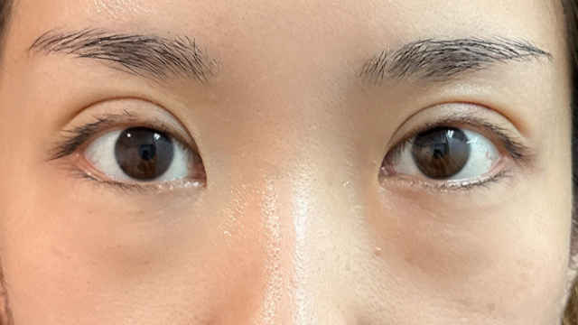 Postoperative Condition Part 1