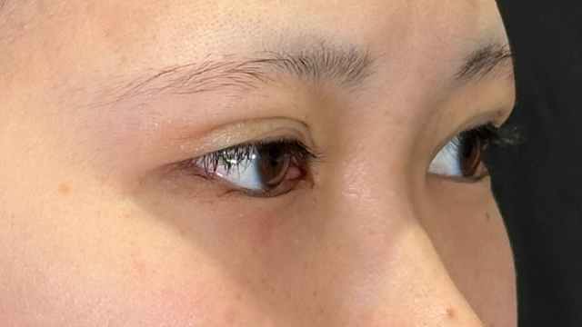 Postoperative Condition Part 1