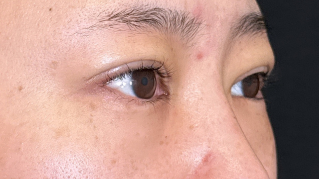 Postoperative Condition Part 1