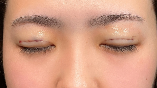 Postoperative Condition Part 1