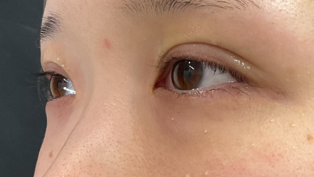 Postoperative Condition Part 1