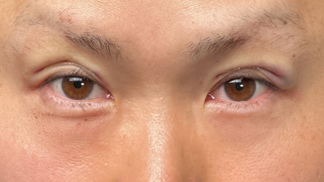 Postoperative Condition Part 1