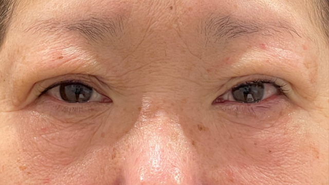 Postoperative Condition Part 1