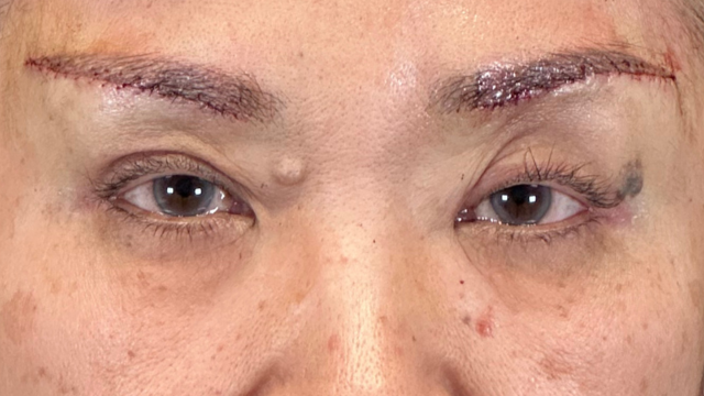 Postoperative Condition Part 1