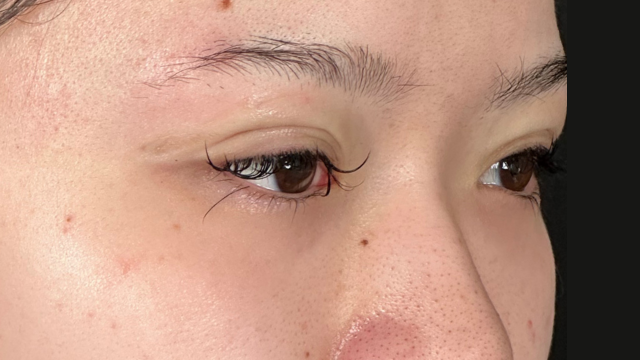 Postoperative Condition Part 1