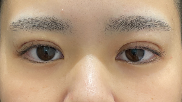 Postoperative Condition Part 1