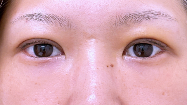 Postoperative Condition Part 1