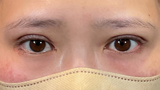 Postoperative Condition Part 1