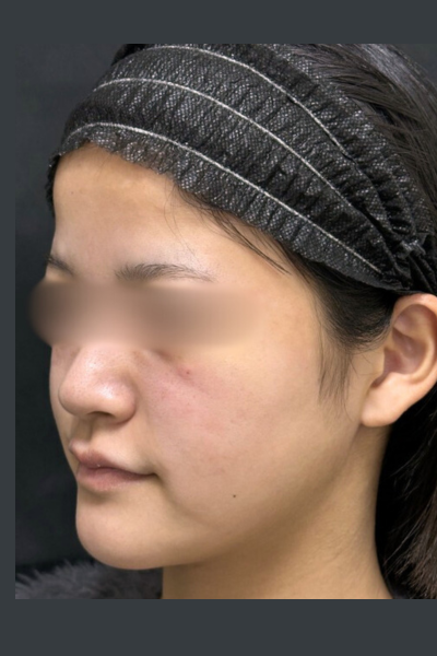 手術前の状態 その1