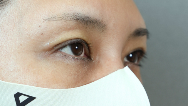 Postoperative Condition Part 1