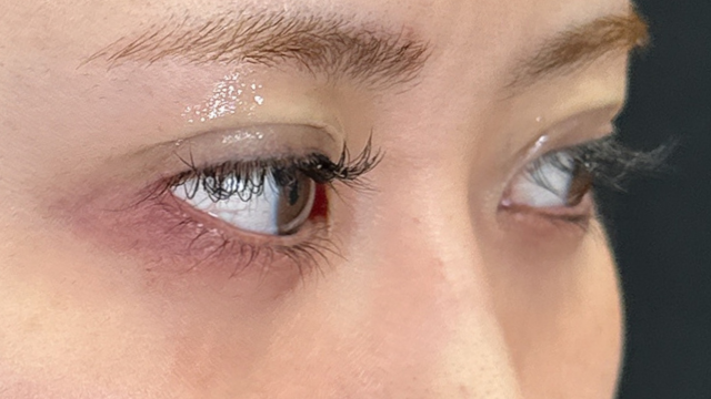 Postoperative Condition Part 1