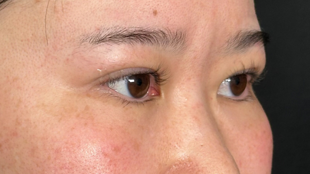 Postoperative Condition Part 1