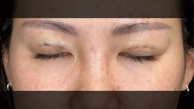 Postoperative Condition Part 1