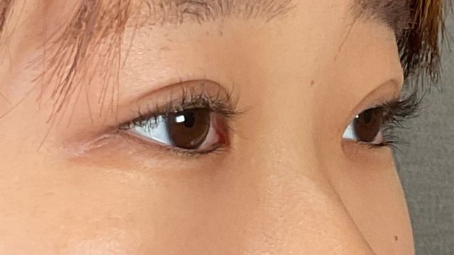 Postoperative Condition Part 1