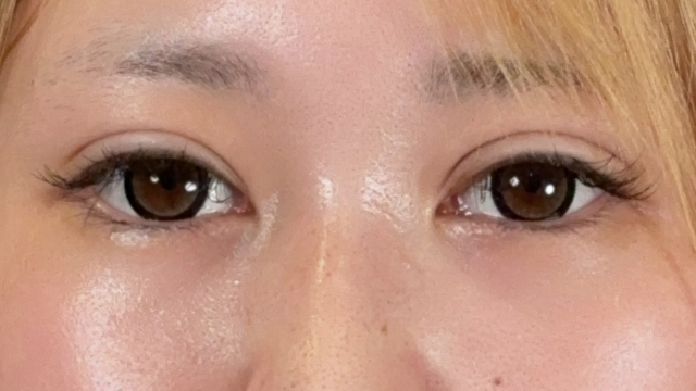 Postoperative Condition Part 1