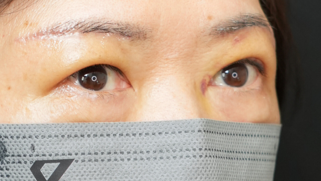 Postoperative Condition Part 1