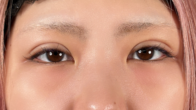 Postoperative Condition Part 1