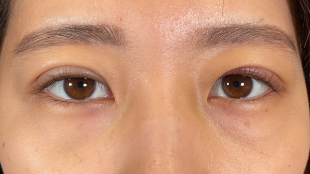 Postoperative Condition Part 1