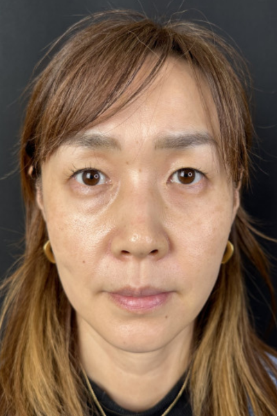 Postoperative Condition Part 1