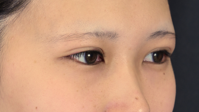 Postoperative Condition Part 1