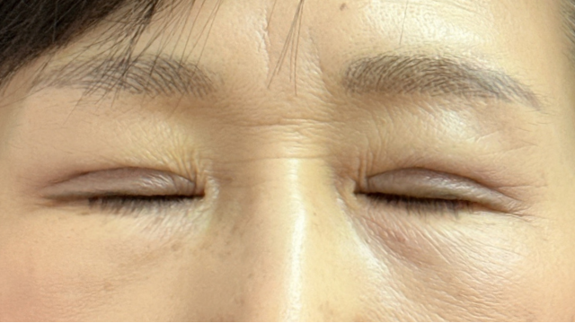 Postoperative Condition Part 1